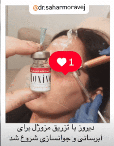 نمونه تزریق مزوژل جوانساز دکتر سحر مروج