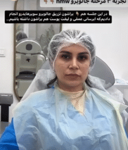نمونه تزریق مزوژل دکتر فرناز ریوجام