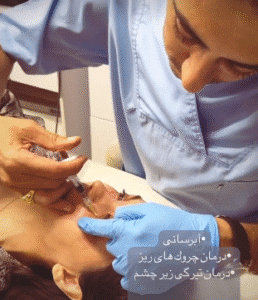 نمونه تزریق مزوژل دکتر محمود جعفری