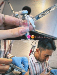 نمونه تزریق مزوژل دکتر محمود جعفری