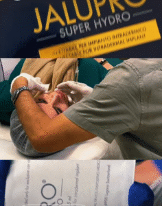 نمونه تزریق مزوژل دکتر محمود جعفری