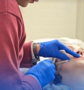 نمونه تزریق مزوژل دکتر محمود جعفری