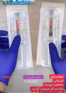 نمونه تزریق مزوژل دکتر محسن پورآریا