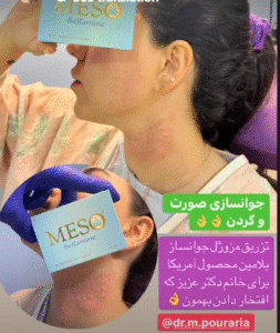 نمونه تزریق مزوژل دکتر محسن پورآریا