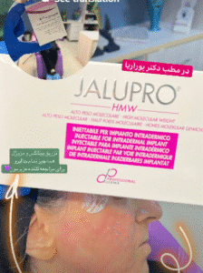 نمونه تزریق مزوژل دکتر محسن پورآریا