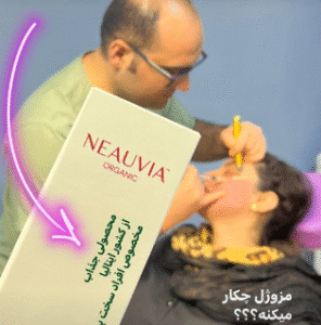 نمونه تزریق مزوژل دکتر محسن پورآریا