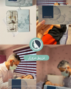 نمونه تزریق مزوژل دکتر صادق هاشمی نسب