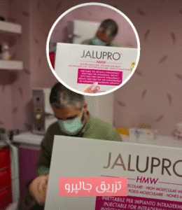 نمونه تزریق مزوژل دکتر صادق هاشمی نسب