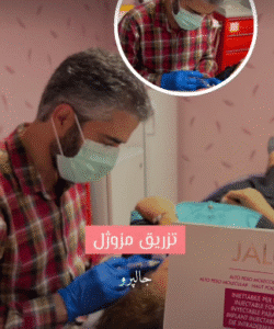 نمونه تزریق مزوژل دکتر صادق هاشمی نسب