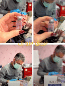 نمونه تزریق مزوژل دکتر صادق هاشمی نسب