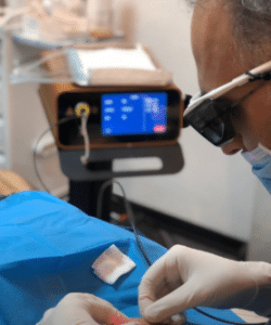 نمونه اندولیفت گروه پزشکی آریا