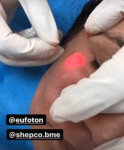 نمونه اندولیفت گروه پزشکی آریا