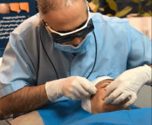 نمونه اندولیفت گروه پزشکی آریا