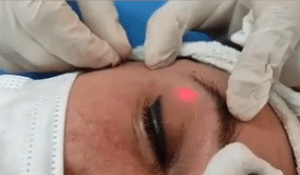 نمونه اندولیفت گروه پزشکی آریا