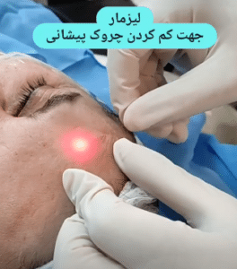 نمونه اندولیفت گروه پزشکی آریا