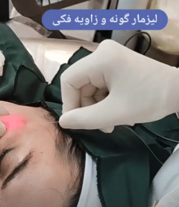 نمونه اندولیفت گروه پزشکی آریا