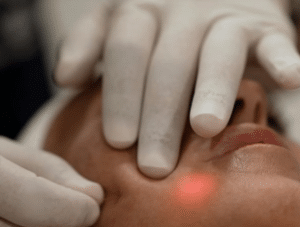 نمونه اندولیفت دکتر نرگس رستمیان