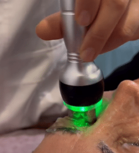 نمونه آر اف فرکشنال دکتر زهره حاج حیدری (کلینیک زیبایی صدف)