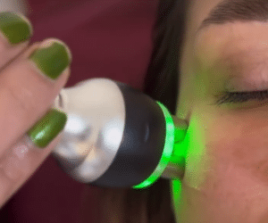 نمونه آر اف فرکشنال دکتر زهره حاج حیدری (کلینیک زیبایی صدف)