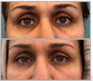 نمونه آر اف فرکشنال دکتر زهره حاج حیدری (کلینیک زیبایی صدف)