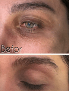 نمونه آر اف فرکشنال دکتر زهره حاج حیدری (کلینیک زیبایی صدف)