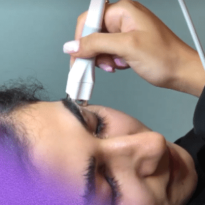 نمونه آر اف فرکشنال دکتر زهره حاج حیدری (کلینیک زیبایی صدف)