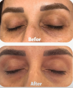 نمونه آر اف فرکشنال دکتر زهره حاج حیدری (کلینیک زیبایی صدف)