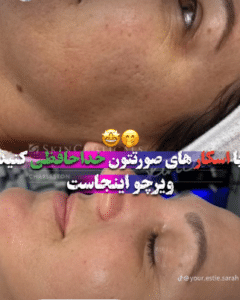 نمونه آر اف دکتر حسین خسروی