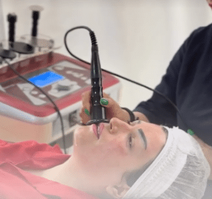 نمونه آر اف فرکشنال دکتر آرزو عوض پور (کلینیک زیبایی افسون)