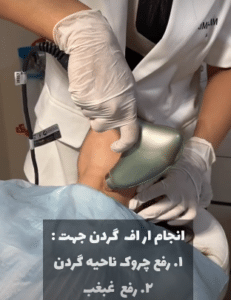 نمونه آر اف دکتر زینب کریمی