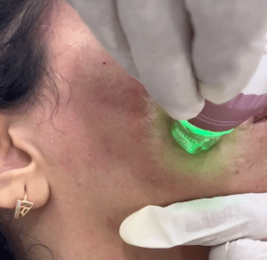 نمونه آر اف فرکشنال دکتر زهرا نورانی