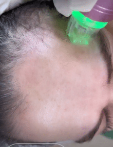 نمونه آر اف فرکشنال دکتر زهرا نورانی