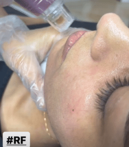 نمونه آر اف فرکشنال دکتر زهرا نورانی