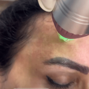 نمونه آر اف فرکشنال دکتر زهرا نورانی