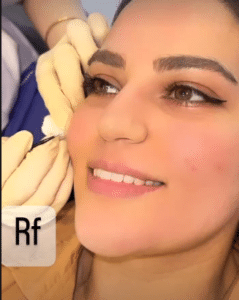 نمونه آر اف دکتر گالیا رنجبری