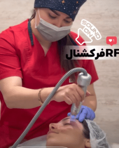 نمونه آر اف فرکشنال دکتر سارا احتشامی