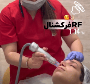 نمونه آر اف فرکشنال دکتر سارا احتشامی