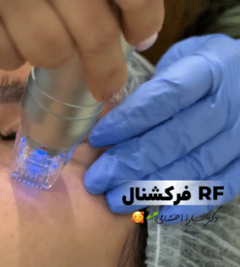 نمونه آر اف فرکشنال دکتر سارا احتشامی