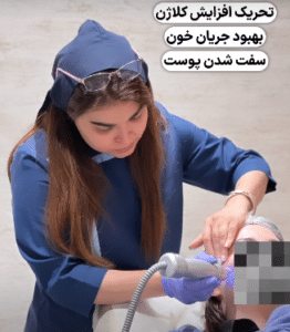 نمونه آر اف فرکشنال دکتر سارا احتشامی