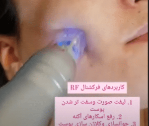 نمونه آر اف فرکشنال کلینیک زیبایی مه رخ