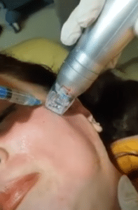 نمونه آر اف فرکشنال کلینیک زیبایی مه رخ