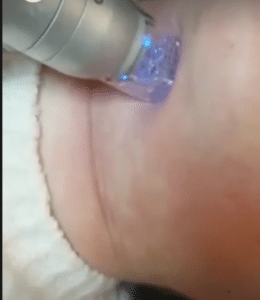 نمونه آر اف فرکشنال کلینیک زیبایی مه رخ