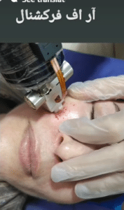 نمونه آر اف فرکشنال دکتر صادق هاشمی نسب