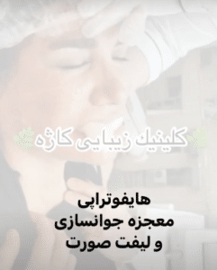 نمونه هایفوتراپی کلینیک زیبایی کاژه