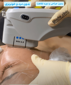 نمونه هایفوتراپی کلینیک زیبایی کاژه