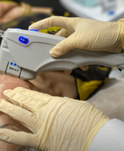 نمونه هایفوتراپی کلینیک زیبایی کاژه