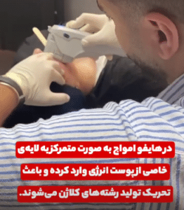 نمونه هایفوتراپی کلینیک زیبایی کاژه