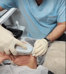 نمونه هایفوتراپی کلینیک زیبایی کاژه