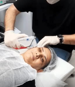 نمونه هایفوتراپی کلینیک زیبایی کاژه