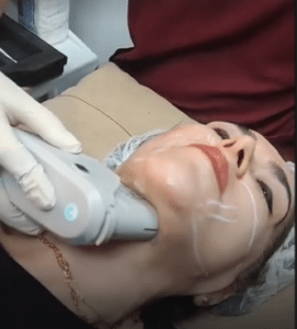 نمونه هایفوتراپی کلینیک زیبایی کاژه